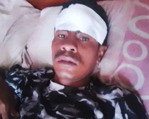 Masalah Asmara, Pemuda di Pulau Semau Disabet dengan Parang