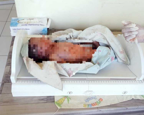 Tragis, Bayi Baru Lahir Diduga Dibunuh Ibu Kandung