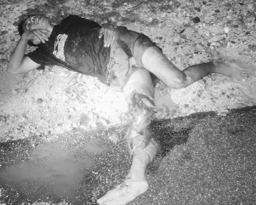 ‎Mabuk Miras dan Geber Motor, Mahasiswa di Kupang Luka Berat Usai Ditabrak Lari Truk