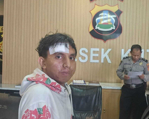‎Tergiur Lowongan Kerja di Bali, Pemuda Asal Sumba Disekap dan Disiksa